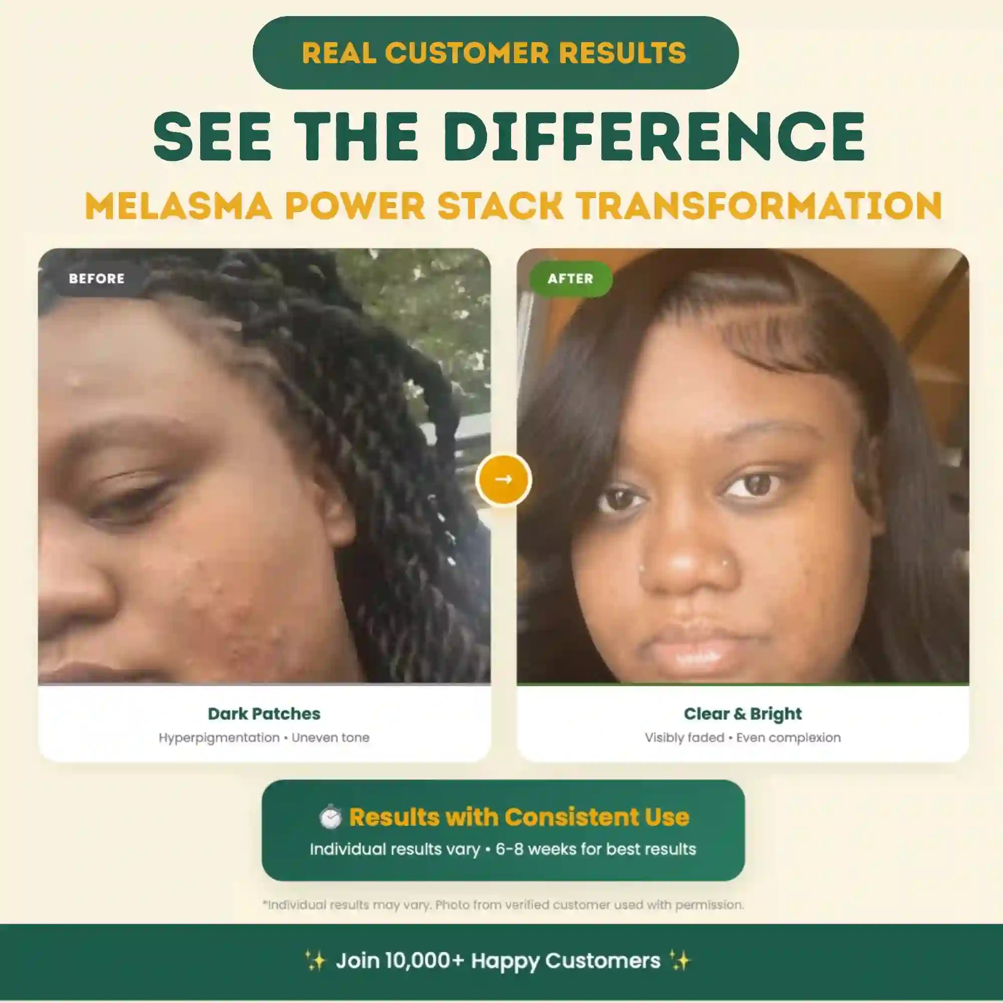 Melasma Power Stack